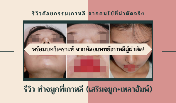 รีวิวทำจมูกที่เกาหลีกับคุณหมอยูน